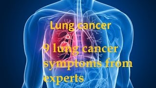 9 lung cancer symptoms from experts [upl. by Kirsch]