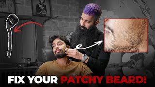 How To Fix Patchy Beard  Patchy Beard Hacks  Beard Growth  Grooming Masterclass EP 2 [upl. by Maribel839]