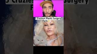 5 craziest plastic surgery fails in English [upl. by Etnuhs]