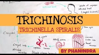 TRICHINOSIS  TRICHINELLA SPIRALIS  STRUCTURE  LIFE CYCLE  SYMPTOMS  BY PHANINDRA GUPTA [upl. by Hime]