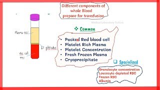 blood components preparation  blood bank  preparation of blood components [upl. by Cristionna]