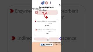 SerodiagnosisGiardia lamblia parasitology microbiology pathology diagnosis neetpg neet [upl. by Naraj]