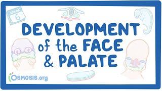 Development of the Face and Palate [upl. by Conlin]