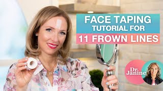 Face Taping Tutorial for 11 Frown Lines  Dr Janine [upl. by Aiden942]