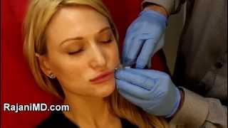 Voluma Microcannula Lip AugmentationRajani Portland [upl. by Allemaj]