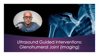 Ultrasound Guided Interventions Glenohumeral Joint Imaging ultrasound [upl. by Daniele980]