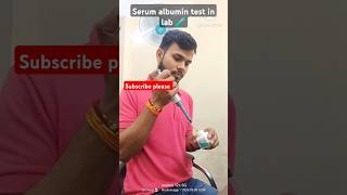 serum albumin test blood Test albuminalbumin bloodtest aj ki rattaiims initialscreening jart [upl. by Ilario274]