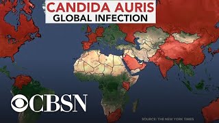 Drugresistant superbug fungus sickens hundreds across the US [upl. by Salome747]