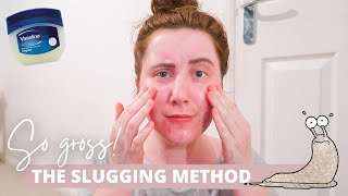 I Tried SLUGGING For A Week With ACNE Prone Skin [upl. by Esile]