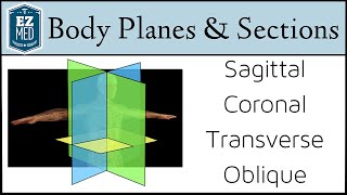 EASY TRICKS for Anatomical Body Planes and Sections DirectionPosition [upl. by Ennaear]