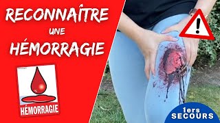 Comment reconnaître une HÉMORRAGIE  ı Formation premiers secours [upl. by Letti58]