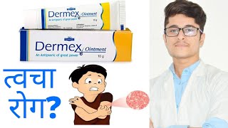 Dermex ointment cream uses in hindi for skin diseases [upl. by Giamo]