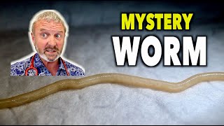 WE FOUND A WORM IN HIS RECTUM What Type Could It Be  Dr Paul [upl. by Hightower]