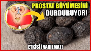 Prostat Büyümesi Varsa Bu Şekilde Kolayca Durdurun [upl. by Alleunamme]