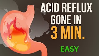 How I Stopped Years of Stomach Acid Reflux or Heart Burn– Here’s What Works [upl. by Ardnuaet]