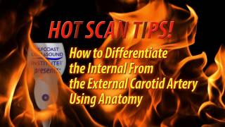 Hot TipHow to Differentiate the Internal from the External Carotid Artery [upl. by Virnelli322]