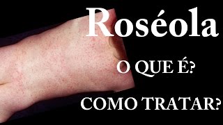 Roséola  O que é  Sintomas  Tratamento [upl. by Accebor]