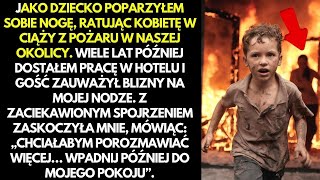 Jako dziecko sparzyłem się ratując kogoś Wiele lat później gość zauważył moje blizny [upl. by Gaves]