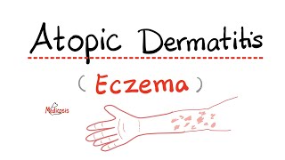 How to prevent Contact Dermatitis on the fingertips  Dr Aruna Prasad [upl. by Nylak]