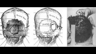 Carl Oglesby The Medical Evidence in the JFK Assassination 1992 [upl. by Aidua]