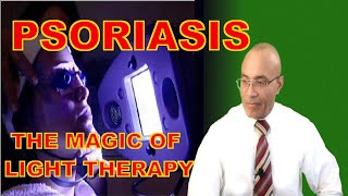 Psoriasis Treatment How Light Therapy Works [upl. by Billi651]