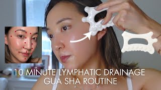 10 Minute Follow Along Lymphatic Drainage Guasha [upl. by Rutra]