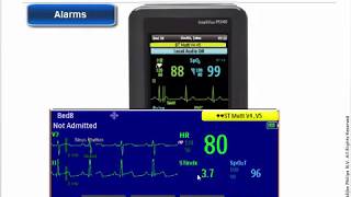 Philips IntelliVue MX40 Patient Monitor  Alarms [upl. by Clower]