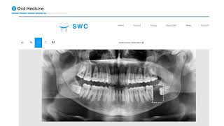 Intelligent Report  AI Reporting For All Dental Cases [upl. by Gusti]