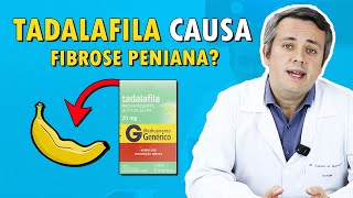 USO PROLONGADO DE TADALAFILA CAUSA FIBROSE PENIANA  Dr Claudio Guimarães [upl. by Amiel294]