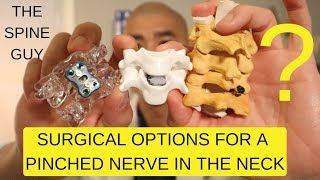 CERVICAL STENOSIS RADICULOPATHY  PART 3  SURGICAL OPTIONS [upl. by Hulton]