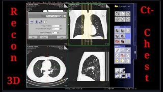 LEARN RECONSTRUCTION CT CHEST SCAN  SIEMENS 16 SLICE [upl. by Beall647]