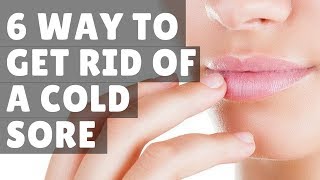 6 WAY to get rid of a cold sore home remedies fast overnight [upl. by Novek]