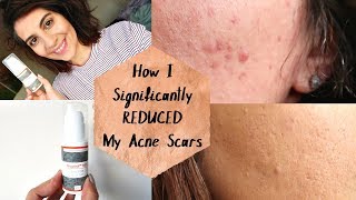 How I Reduced My Old Acne Scars Nourisil Md Silicone Scar Gel  Natasha Summar AD [upl. by Hallam]