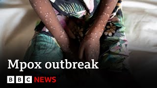 What is mpox and how is it spread  BBC News [upl. by Ave]