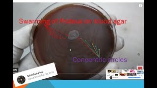 Swarming of proteus on blood agar  swarming inhibition by various methods Swarming [upl. by Eneleahs406]