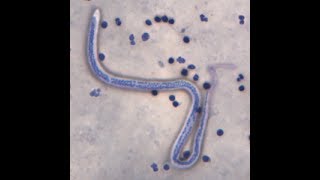 Microflilria MF of Wuchereria bancrofti under vital stained slide [upl. by Oelc]