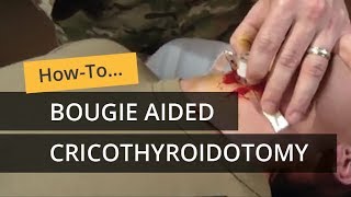 Bougie Aided Cricothyroidotomy [upl. by Hardej]