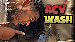 11 YEAR LOCS  ACV RINSE GREAT RESULTS  Highly Recommend [upl. by Hank]