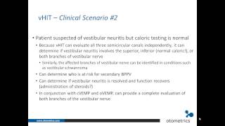 ICS Impulse vHIT Clinical applications [upl. by Uot]