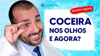 What I Learned from 100 Patients with Coceira nos Olhos Will Surprise You [upl. by Einnep]