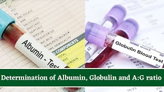 Determination Of Albumin and Globulin Total Protein Test And AlbuminGlobulin AG Ratio [upl. by Nesnah]