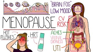 Menopause Explained Clearly Includes HRT amp Perimenopause [upl. by Ramiah]