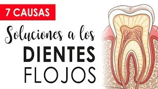 CUIDADO CON LOS DIENTES FLOJOS  CAUSAS Y SOLUCIONES 😱 [upl. by Adianez404]