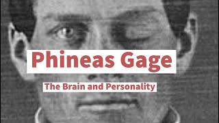 Phineas Gage a case study [upl. by Kelsey]