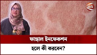 গরমে বেড়ে যায় ফাঙ্গাল ইনফেকশন কী করা উচিৎ  Fungal Infection  Dr Fahmida  Channel 24 [upl. by Rinaldo]