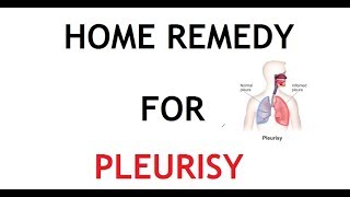 5 Home Remedy for Pleurisy [upl. by Zerline]