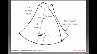 Ultrasound Physics 4  Beam Geometry [upl. by Zippora]