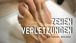 Zehenverletzungen Zehenbrüche und Dachziegelverband Tutorial [upl. by Elockcin]