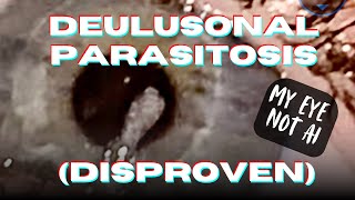 Delusional Parasitosis disproven [upl. by Stuart]