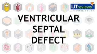 Atrial Septal Defect  Heart Sounds  MEDZCOOL [upl. by Eltotsira]